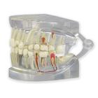 Mâchoire humaine transparente avec modèle dentaire, 1019540, Modèles dentaires