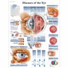 Diseases of the Eye, 4006666 [VR1231UU], Yeux