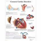 Common Cardiac Disorders, 1001526 [VR1343L], système cardiovasculaire