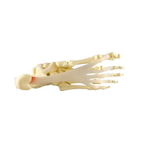 Modèle de fasciite plantaire – pied/cheville, 1019522, Modèles de squelettes des membres inférieurs