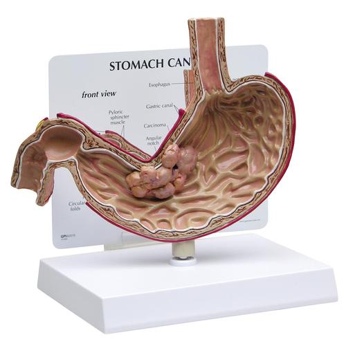 Modèle de cancer de l’estomac, 1019524, Modèles de systèmes digestifs