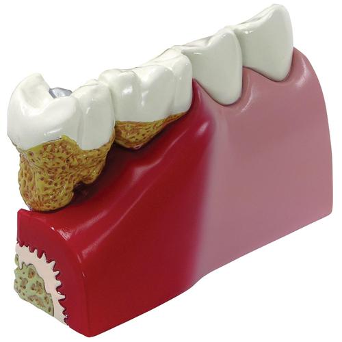 Modèle dentaire, 1019539, Modèles dentaires