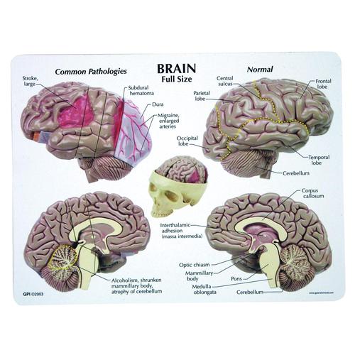 Modèle de cerveau, 1019542, Modèles de cerveaux