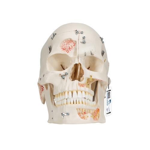 Crâne de démonstration de luxe, en 10 parties - 3B Smart Anatomy, 1000059 [A27], Modèles de moulage de crânes humains