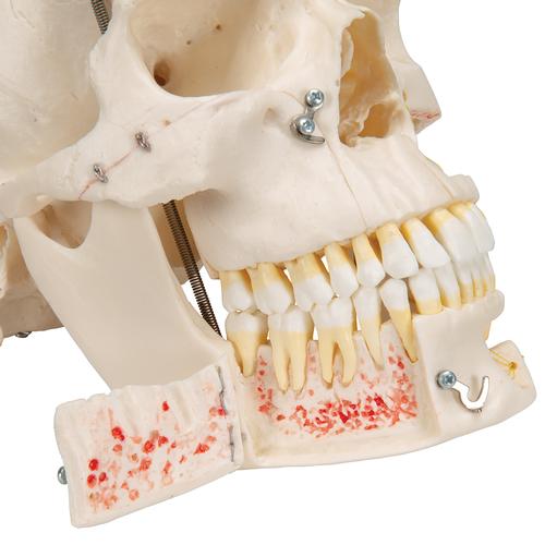 Crâne de démonstration de luxe, en 10 parties - 3B Smart Anatomy, 1000059 [A27], Modèles de moulage de crânes humains