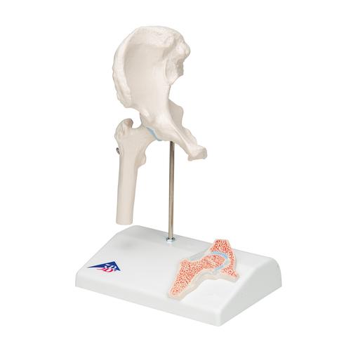 Mini-articulation de la hanche avec coupe transversale, sur socle - 3B Smart Anatomy, 1000168 [A84/1], Modèles d'articulations
