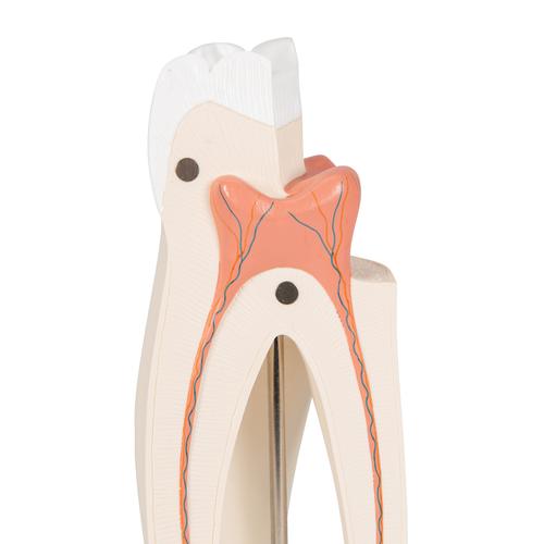 Molaire supérieure à trois racines, en 3 parties - 3B Smart Anatomy, 1017580 [D10/5], Modèles dentaires