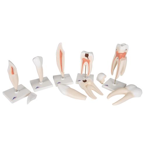 Série de 5 modèles de dents - 3B Smart Anatomy, 1017588 [D10], Modèles dentaires