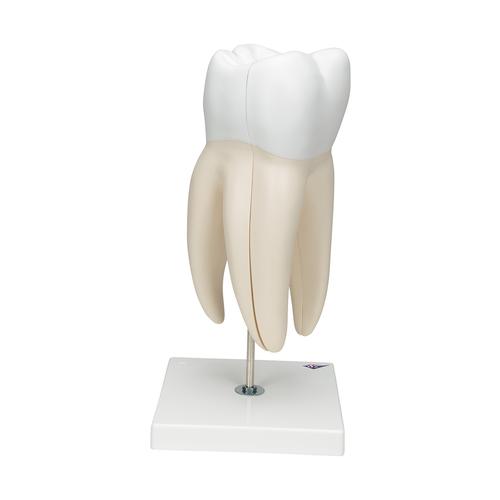 Molaire supérieure à trois racines, en 6 parties (avec carie) - 3B Smart Anatomy, 1013215 [D15], Modèles dentaires