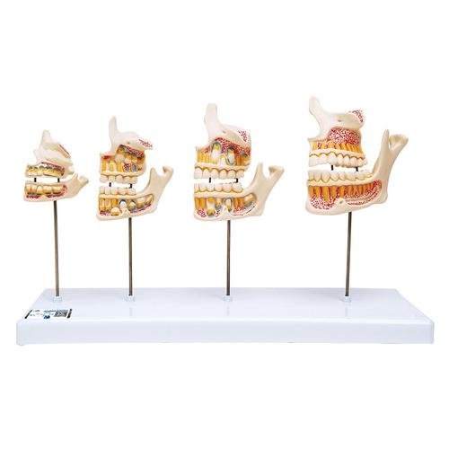 Développement de la dentition - 3B Smart Anatomy, 1000248 [D20], Modèles dentaires