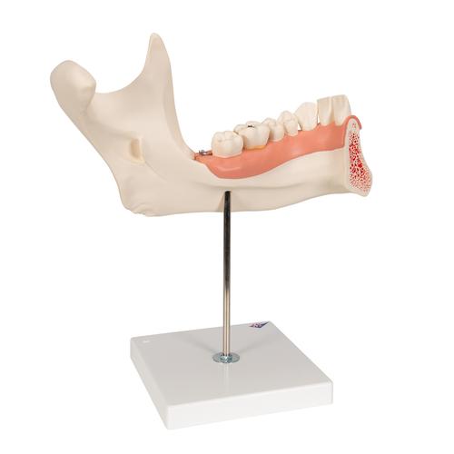 Hémi-mandibule, agrandie 3 fois, en 6 parties - 3B Smart Anatomy, 1000249 [D25], Modèles dentaires