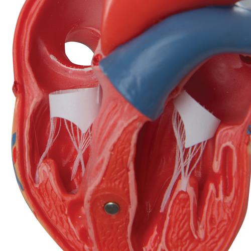 Cœur classique, en 2 parties - 3B Smart Anatomy, 1017800 [G08], Éducation Santé du Coeur et Fitness