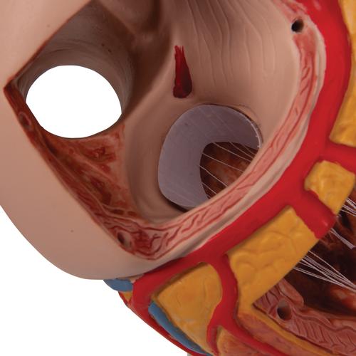 Modèle anatomique du cœur humain, agrandi 2 fois, en 4 parties - 3B Smart Anatomy, 1000268 [G12], Éducation Santé du Coeur et Fitness