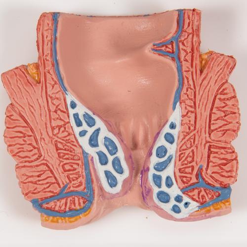 Modèle d'hémorroïdes - 3B Smart Anatomy, 1000315 [K27], Modèles de systèmes digestifs
