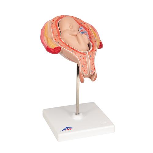 Fœtus, à 5 mois, présentation du siège - 3B Smart Anatomy, 1018630 [L10/5], Homme