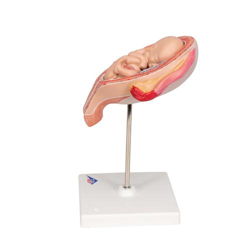 Fœtus, à 5 mois, présentation du siège - 3B Smart Anatomy, 1018630 [L10/5], Modèles de grossesse