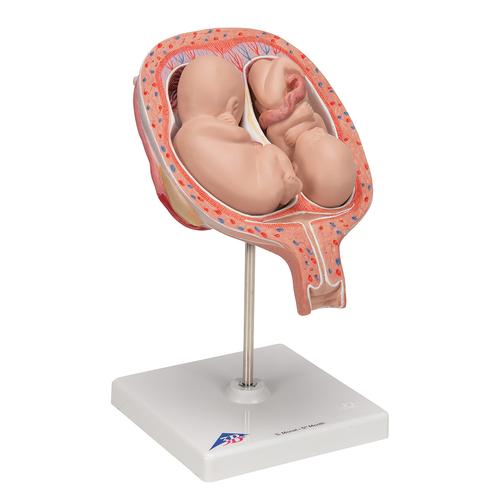 Fœtus jumeaux à 5 mois, position normale - 3B Smart Anatomy, 1000328 [L10/7], Modèles de grossesse