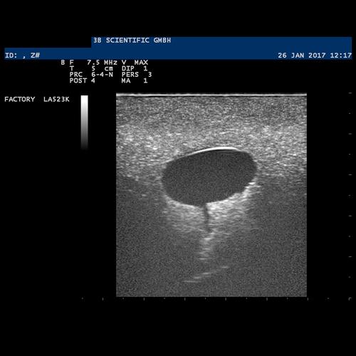 SONOtrain Modèle de sein avec kystes, 1019634 [P124], Ultrasound Skill Trainers