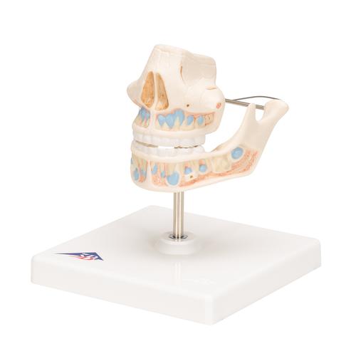 Dentition de lait - 3B Smart Anatomy, 1001248 [VE282], Modèles dentaires