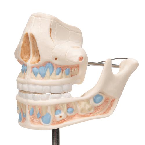 Dentition de lait - 3B Smart Anatomy, 1001248 [VE282], Modèles dentaires