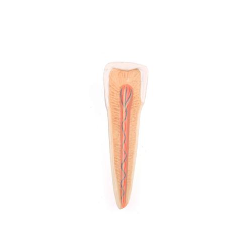 Hémi-mandibule, avec 8 dents cariées, en 19 parties - 3B Smart Anatomy, 1001250 [VE290], Modèles dentaires