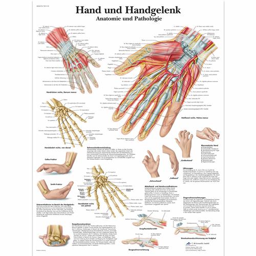 Hand und Handgelenk - Anatomie und Pathologie, 1001318 [VR0171L], système Squelettique