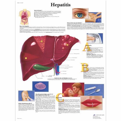 Hepatitis, 4006611 [VR0435UU], Système métabolique