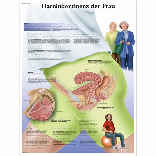Harninkontinenz der Frau, 4006620 [VR0542UU], Gynécologie

