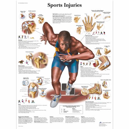 Sports Injuries, 4006664 [VR1188UU], Muscle

