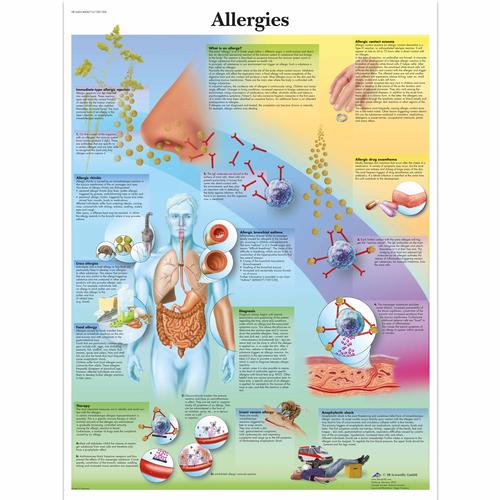 Allergies, 4006715 [VR1660UU], Éducation Asthme et Allergies
