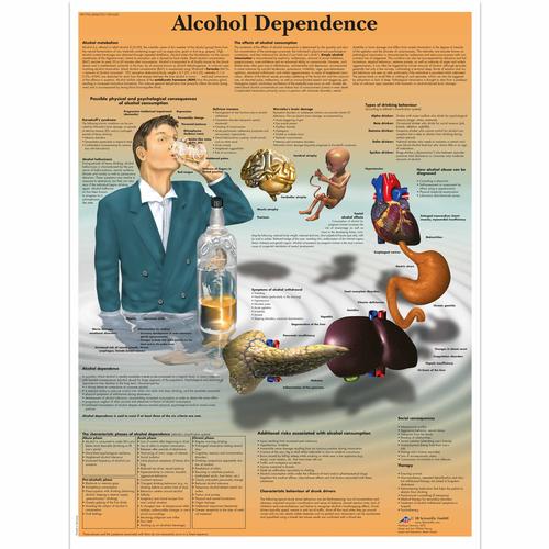 Alcohol Dependence, 4006727 [VR1792UU], Prévention drogues et alcools