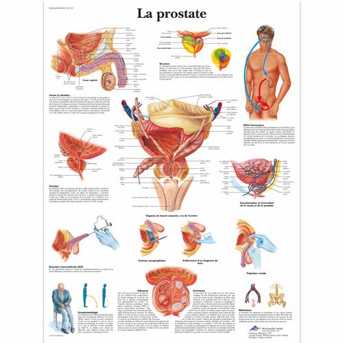 La prostate, 4006783 [VR2528UU], Système urinaire
