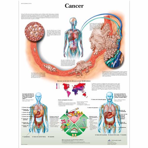 Cancer, 1001781 [VR2753L], Cancers

