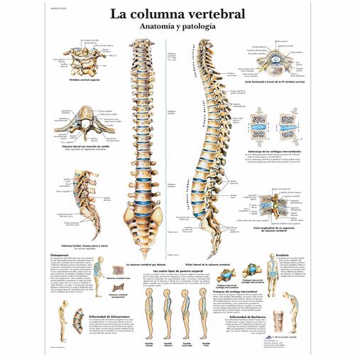 La columna vertebral - Anatomía y patología, 4006820 [VR3152UU], système Squelettique