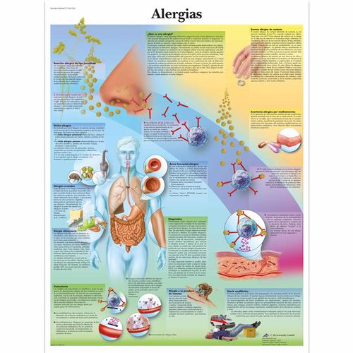 Alergias, 1001925 [VR3660L], Système immunitaire