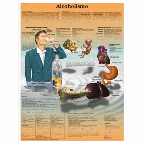 Alcoholismo, 4006891 [VR3792UU], Dépendance