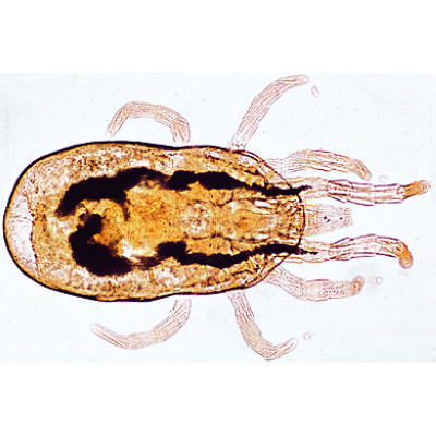 Arachnides et myriapodes - Allemand, 1003863 [W13005], Préparations microscopiques LIEDER