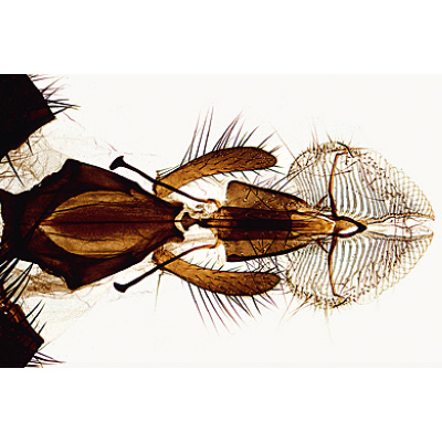 Insectes, série élémentaire grossie - Portugais, 1003869 [W13006P], Préparations microscopiques LIEDER