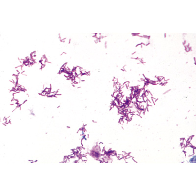 Série de base de bactéries - Français, 1003885 [W13011F], Préparations microscopiques LIEDER