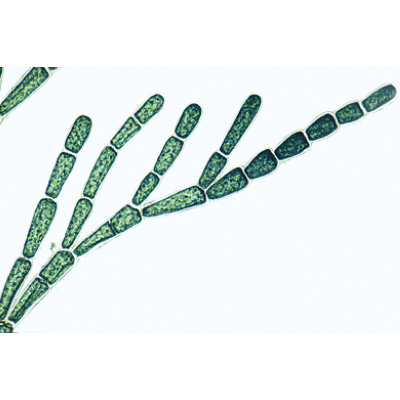 Algues - Allemand, 1003888 [W13012], Lames microscopiques Allemand