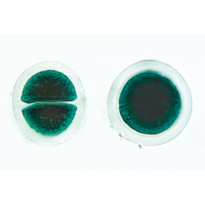 Algues - Portugais, 1003890 [W13012P], Préparations microscopiques LIEDER