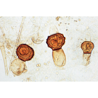 Champignons et lichens - Allemand, 1003892 [W13013], Préparations microscopiques LIEDER