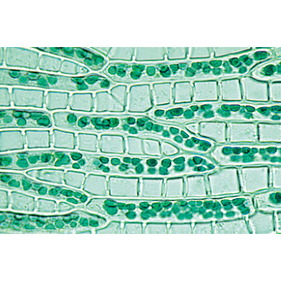Bryophytes (sphaignes et mousses) - Français, 1003897 [W13014F], Lames microscopiques Français
