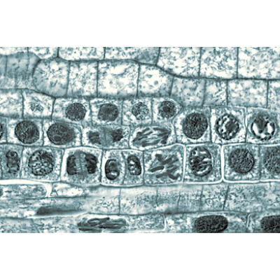 Angiospermes, cellules et tissus - Français, 1003909 [W13017F], Lames microscopiques Français