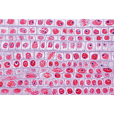 Angiospermes, racines - Français, 1003913 [W13018F], Lames microscopiques Français