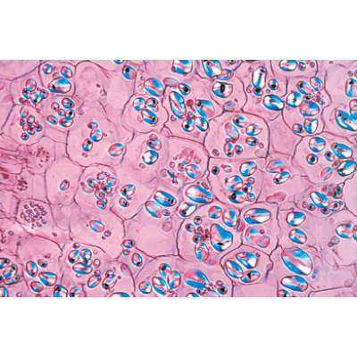 Angiospermes, tiges - Allemand, 1003916 [W13019], Préparations microscopiques LIEDER