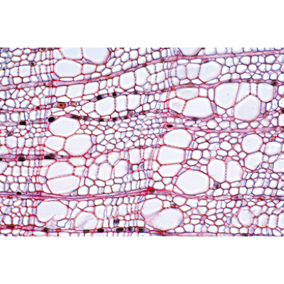 Angiospermes, tiges - Français, 1003917 [W13019F], Préparations microscopiques LIEDER