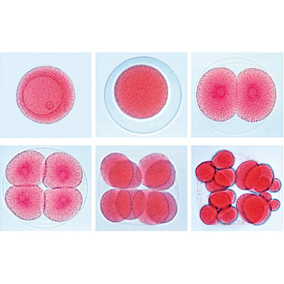 Série de lames génétiques - Allemand, 1003940 [W13025], Préparations microscopiques LIEDER