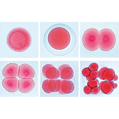 Série de lames génétiques - Espagnol, 1003943 [W13025S], Préparations microscopiques LIEDER