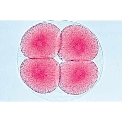 Embryologie de l’oursin de mer (Psammechinus miliaris) - Espagnol, 1003947 [W13026S], Préparations microscopiques LIEDER